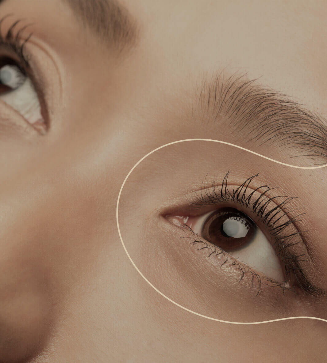 Scarless Eyelid Technique